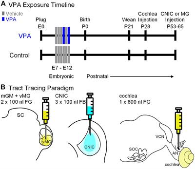 The Untouchable Ventral Nucleus of the Trapezoid Body: Preservation of a Nucleus in an Animal Model of Autism Spectrum Disorder